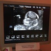 фотография Лилия Гвоздяная фотография Лилия Гвоздяная