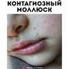 разместить рекламу в блоге Анна Левадная разместить рекламу в блоге Анна Левадная