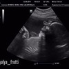 заказать рекламу у блоггера lyalya_frutti заказать рекламу у блоггера lyalya_frutti