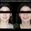 новое фото Артур Кадыраджиев новое фото Артур Кадыраджиев